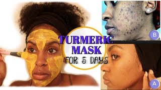 I Used a TURMERIC MASK for 1 Week and THIS HAPPENED  How to Fade Dark Spots [upl. by Aerona301]