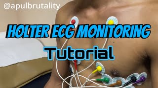 Holter ECG monitoring tutorial  placement recording and interpretation [upl. by Odrautse497]