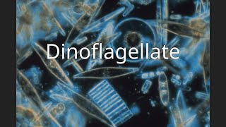 Dinoflagellate [upl. by Llennaj]