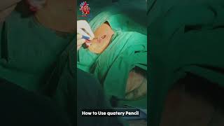 Pencil used in surgery pencil use inPPI pacemaker cathlab [upl. by Ydaf]