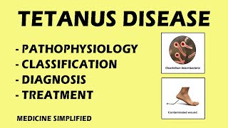 Tetanus  Tetanus Pathophysiology  Tetanus Classification  Tetanus Treatment medicine [upl. by Karry]