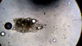 Microscope Sputum Analysis  Ciliated Cells Wiggly Wiggly [upl. by Sayer]