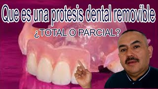 Como es una prótesis dental removible y como funciona [upl. by Brok]