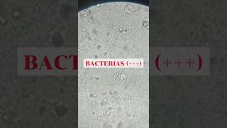 Bacterias en orina vistas al microscopio laboratorioclinico ciencia medicina curiosidades [upl. by Michelina]