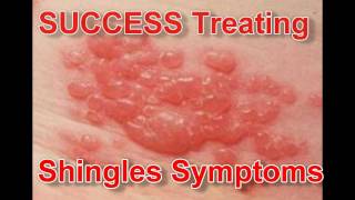 treating shingles naturally [upl. by Ramej]