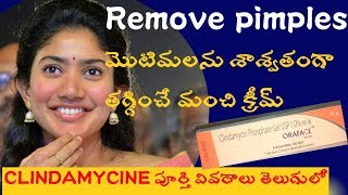 Clindamycine phosphate gel Use amp review in telugu How to remove pimples CREAMS FOR PIMPLES [upl. by Aelanej]