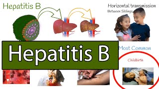 Hepatitis B symptoms treatment and prevention [upl. by Llertak]