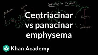 Centriacinar emphysema vs panacinar emphysema  NCLEXRN  Khan Academy [upl. by Pascal]