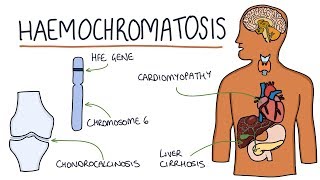 Understanding Haemochromatosis [upl. by Dyun396]