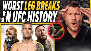 BISPING THE MOST SHOCKING LEG BREAKS IN UFC HISTORY [upl. by Knick]