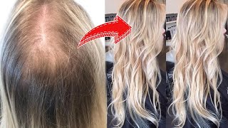 5 LIFE CHANGING HACKS FOR THIN amp FINE HAIR must watch [upl. by Nevek]