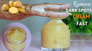 Best homemade cream for dark spots  Dark Spots Removal Cream [upl. by Ahsirak]