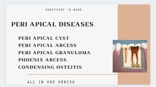 DISEASES OF PERIAPICAL TISSUE [upl. by Scherman]