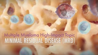 Minimal Residual Disease MRD  High Impact Topic HIT [upl. by Levitan]