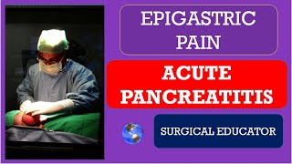 ACUTE PANCREATITIS How To DIAGNOSE amp TREAT EPIGASTRIC PAIN [upl. by Ertemed]