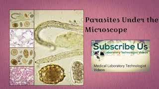 Parasites Under The Microscope [upl. by Anavas426]