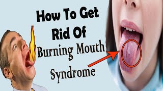 How To Get Rid Of Burning Mouth Syndromes  Home Remedies For Burning Mouth Syndromes [upl. by Gannes]