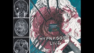 Hardwired Human  Hypnagogic Full live [upl. by Eehsar]