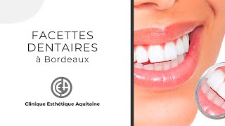 Facettes dentaires  Clinique Esthétique Aquitaine [upl. by Ataliah]