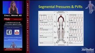 Diagnosis and Imaging in Acute and Chronic Limb Ischemia Erica L Mitchell MD [upl. by Theone]