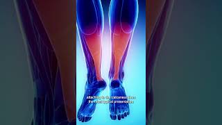 Help Treat Achilles Tendinopathy With Deep Transverse Friction [upl. by Yggep]