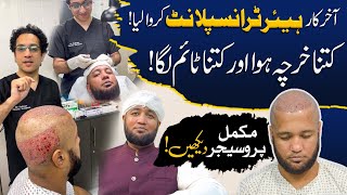 Hafiz Ahmed Hair Transplant Complete Procedure  Hafiz Ahmed [upl. by Culberson]