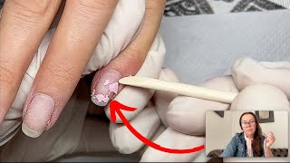 Can Shellac damage nails Nail technician explains what happens [upl. by Alrad993]