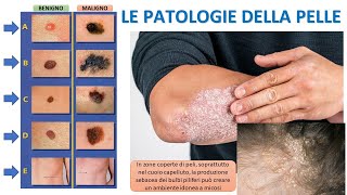 LE PATOLOGIE DELLA PELLE [upl. by Nomelif]