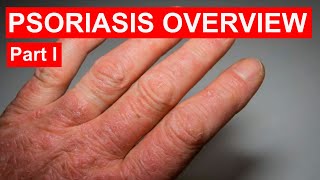 Psoriasis Overview  symptoms types causes triggers risk factors and complications [upl. by Allebasi946]