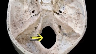 MNEMONIC  Foramen Magnum [upl. by Iruyas]