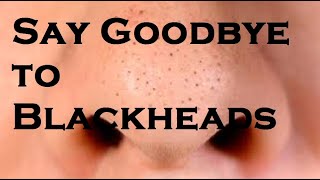 Say Goodbye to Blackheads [upl. by Cirad167]