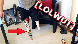 My CRAZY Custom Prosthetic Leg Double Amputee [upl. by Alleda]