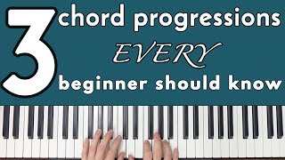 Common Chord Progressions Every Beginner Should Know [upl. by Dallas]