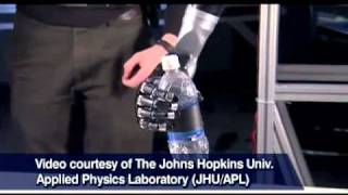 Modular Prosthetic Limb Demonstration  HDT Robotics [upl. by Wendin]