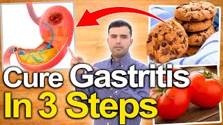 CURE GASTRITIS IN 3 SIMPLE STEPS  Heartburn Stomach Pain and Indigestion NO MORE [upl. by Suilmann]