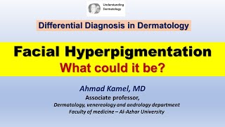 Facial hyperpigmentation What could it be [upl. by Akemahs]