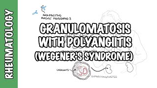 Granulomatosis with Polyangiitis pathophysiology symptoms treatment [upl. by Deutsch]