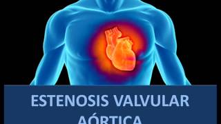 Estenosis valvular aórtica  Fisiopatología [upl. by Ahsoym]