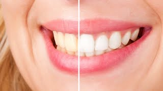 Best Whitening Toothpaste 2022  Top 5 Whitening Toothpastes [upl. by Ennayr441]