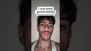 1 year beard growth journey minoxidil beard transformation shorts [upl. by Ahsinahs]