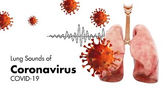 Sounds of Coronavirus COVID19  Lung Sounds [upl. by Marybella]