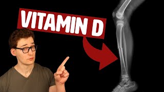 Does Vitamin D Supplementation actually improve Bone Health Study 329333 Analysis [upl. by Roselane39]