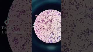 Gram positive cocci identification bacteria staphylococcus microscope [upl. by Capriola313]