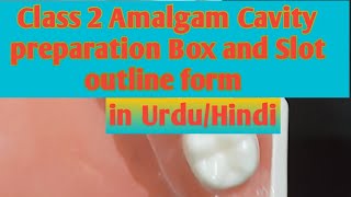 Class 2 Amalgam Cavity preparation Tunnel slotbox outline form in UrduHindiMBBS and BDS lecture [upl. by Wojak887]