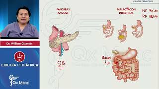 Páncreas anular y Malrotación intestina [upl. by Zzaj]