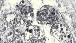 Toxoplasmosis amp Toxoplasma gondii [upl. by Terrence]