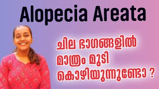 Alopecia areata Malayalam health tips  മുടികൊഴിച്ചിൽ ഇങ്ങനെയുണ്ടോ നിങ്ങൾക്ക്  alopeciaareata [upl. by Idalina]