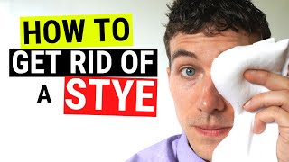 How to Get Rid of a Stye FAST  Chalazion VS Stye Treatment [upl. by Oech]