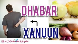 Dhabar Xanuunka Oo Xal Waara Loo Helay [upl. by Tavia]