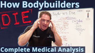 How Bodybuilders Die  Complete Medical Analysis [upl. by Onailil]